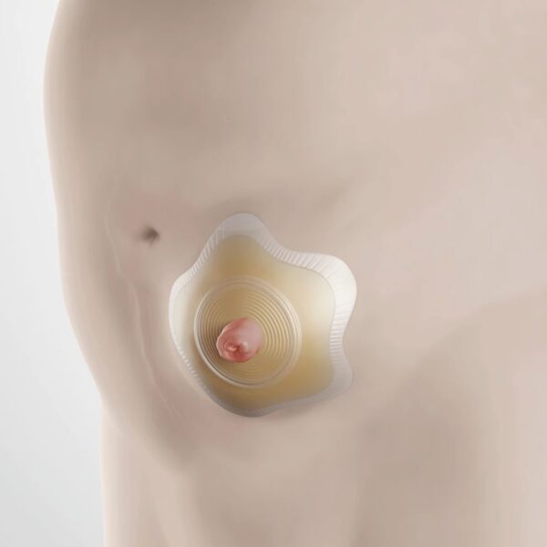 SenSura Mio Convex Flip Ostomy Barrier with 30 mm Stoma Opening, Red Match - Image 4