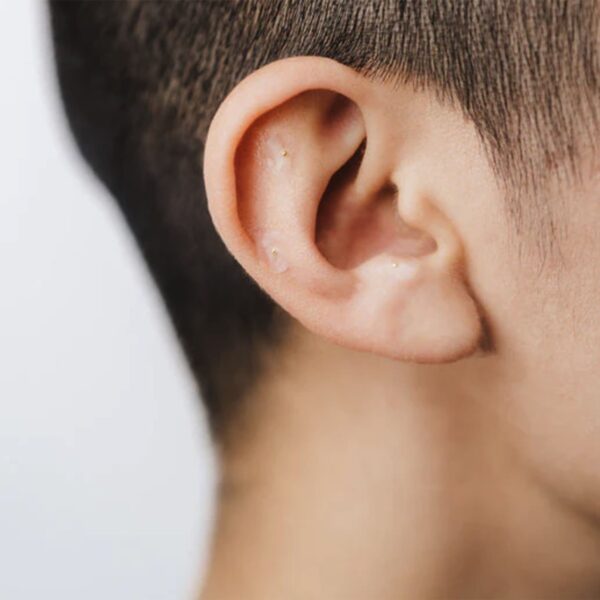 Kanjo Acupressure Ear Seeds - Pain Relief with 20 Silver Adhesive Stimulators - Image 6